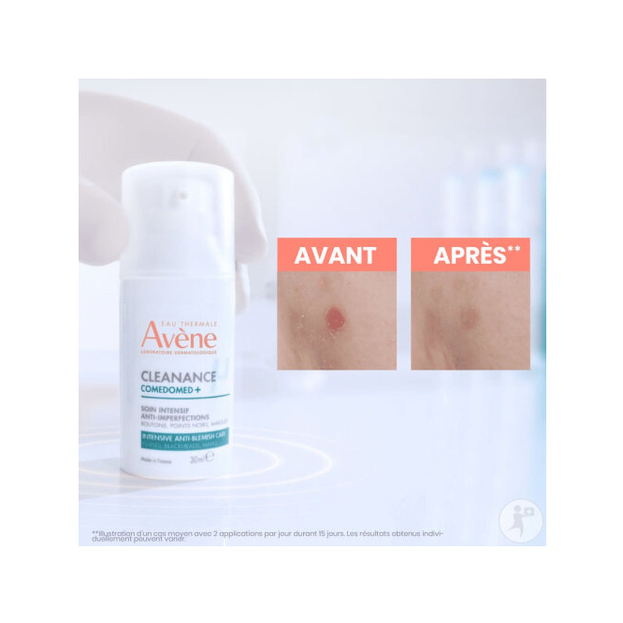 Avène Cleanance Comedomed+ Soin Intensif Anti-Imperfections 30ml