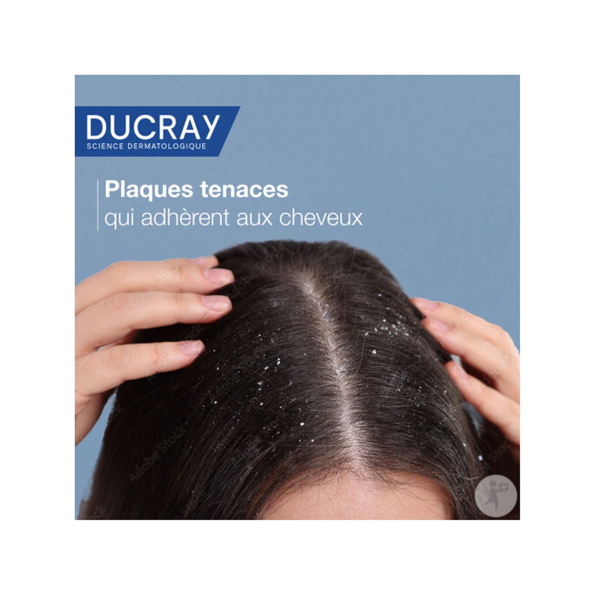 Ducray Kelual Squanorm Shampoing Traitant Régulateur Anti-Pelliculaire Pellicules Grasses 400ml