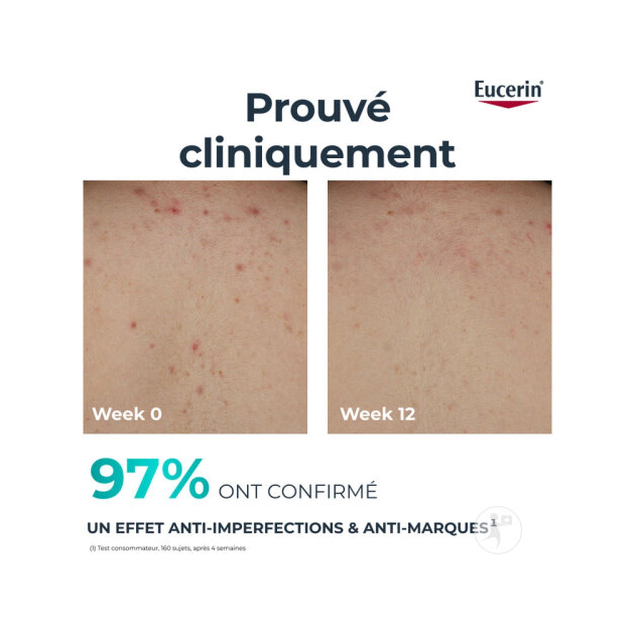 Eucerin Dermopure Clinical Crème Pour Le Corps Triple Action 200ml