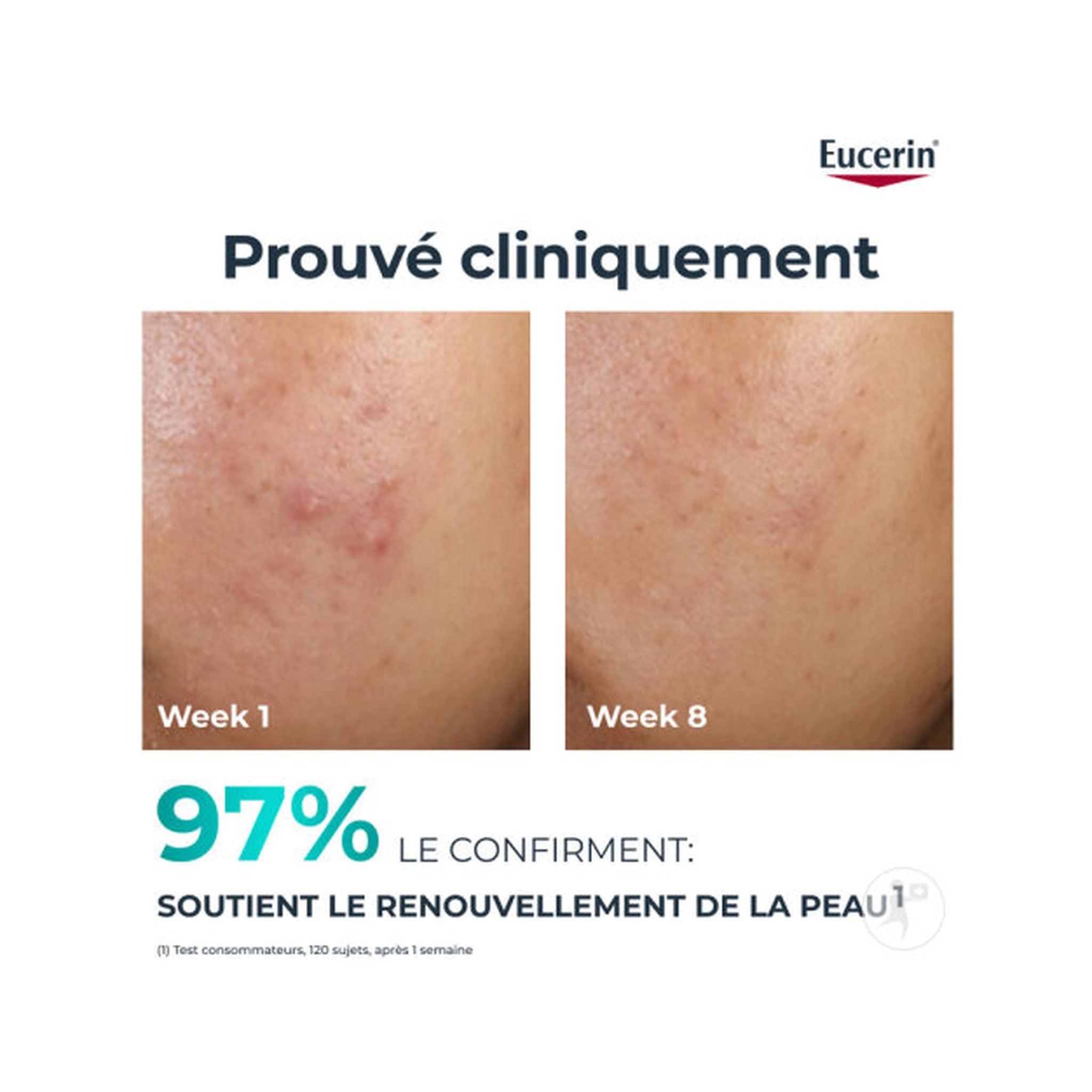 Eucerin Dermopure Clinical Peeling 10 Soin De Nuit Rénovateur 40ml