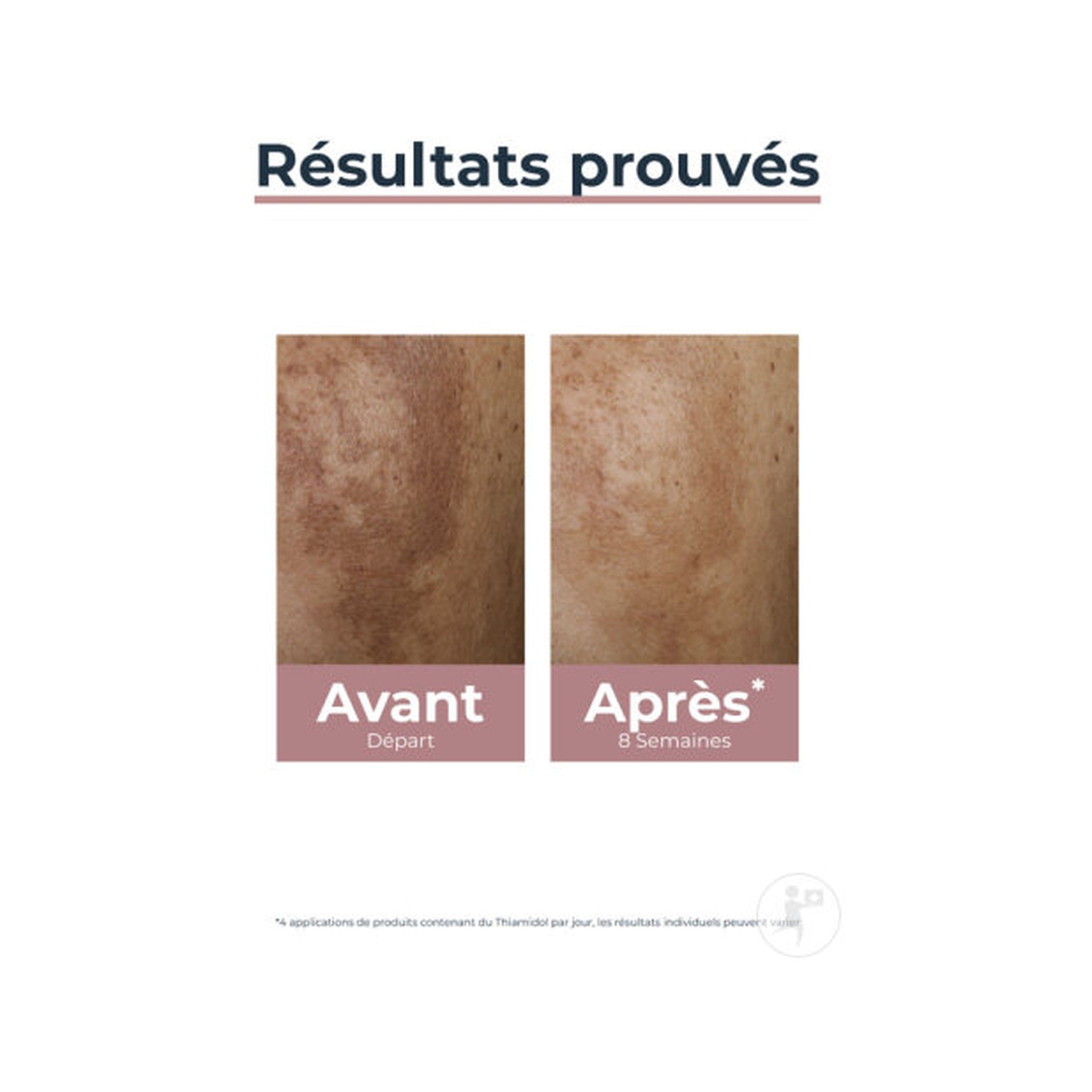 Eucerin Hyperpigmentation Anti-Pigment Correcteur De Taches Toutes Peaux 5ml