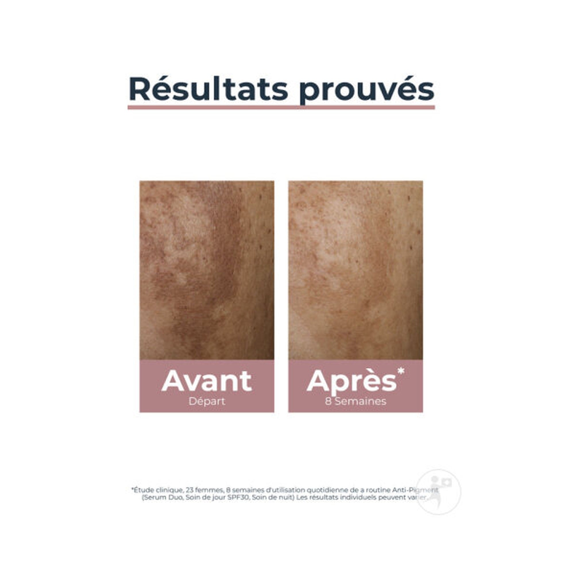 Eucerin Hyperpigmentation Anti-Pigment Sérum Duo Toutes Peaux Flacon 30ml
