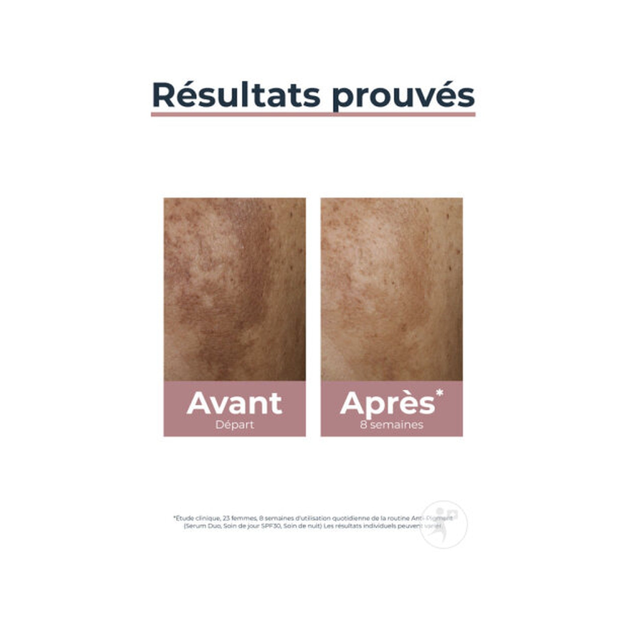 Eucerin Hyperpigmentation Anti-Pigment Soin De Jour IP30 Toutes Peaux Flacon 50ml