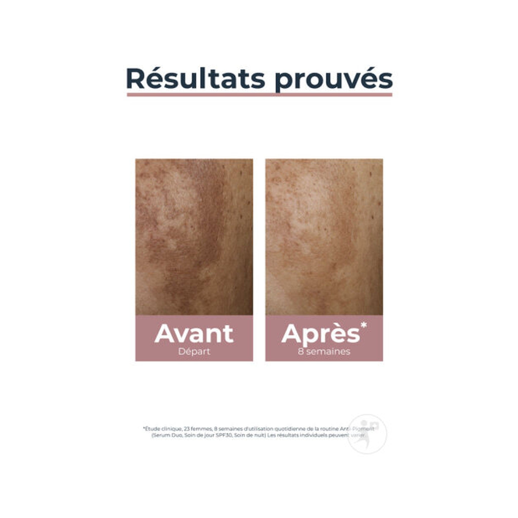 Eucerin Hyperpigmentation Anti-Pigment Soin De Nuit Toutes Peaux Flacon 50ml