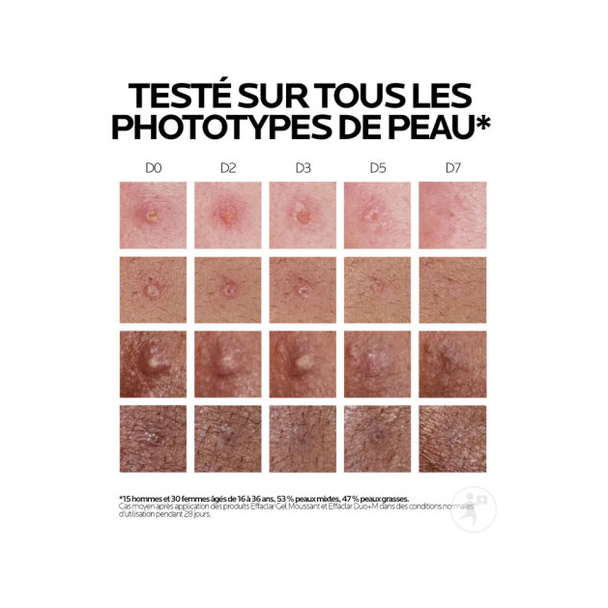 La Roche-Posay Effaclar Duo+M Crème Jour Triple Correction Anti-Imperfections Tube 40ml