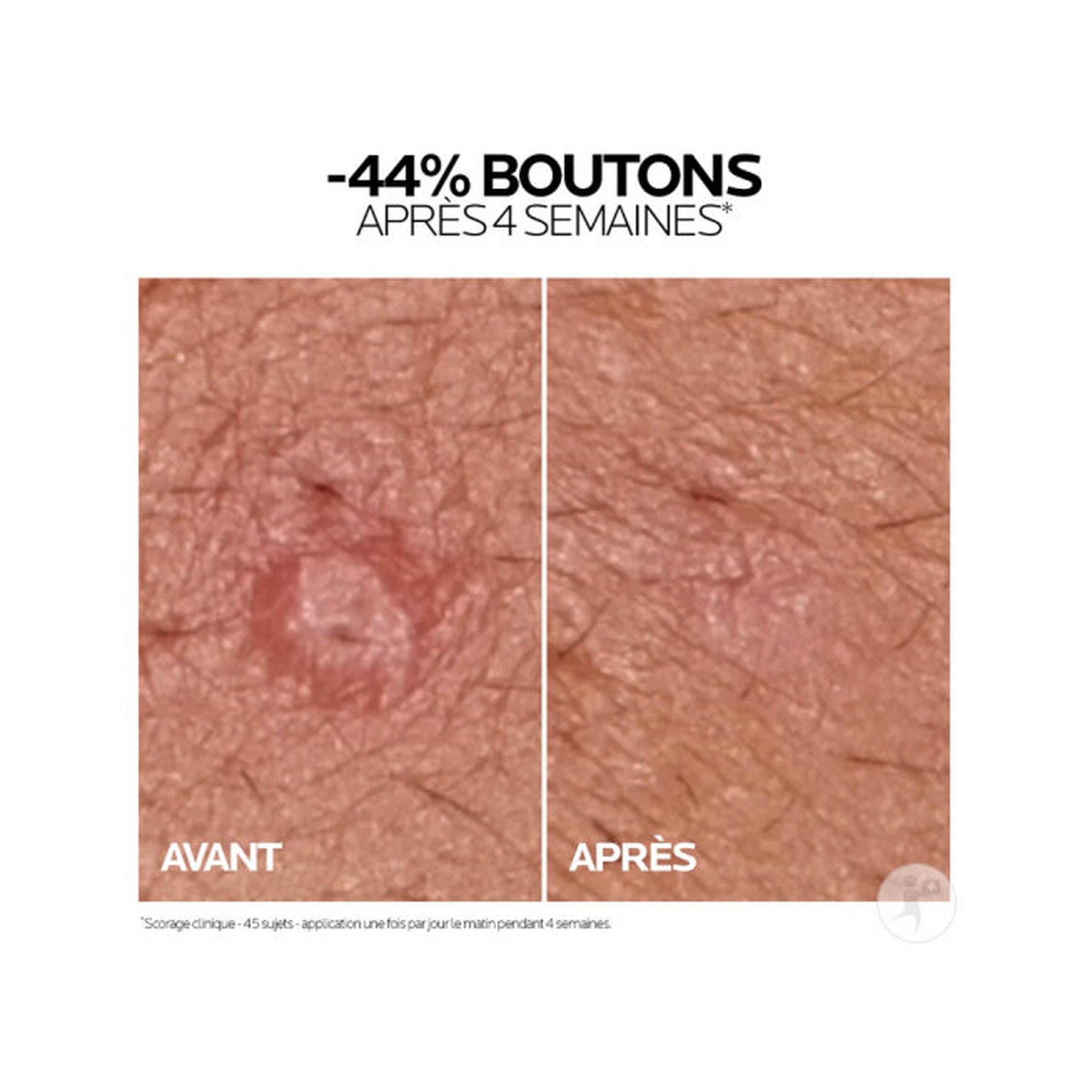 La Roche-Posay Effaclar Duo+M Crème Jour Triple Correction Anti-Imperfections Tube 40ml