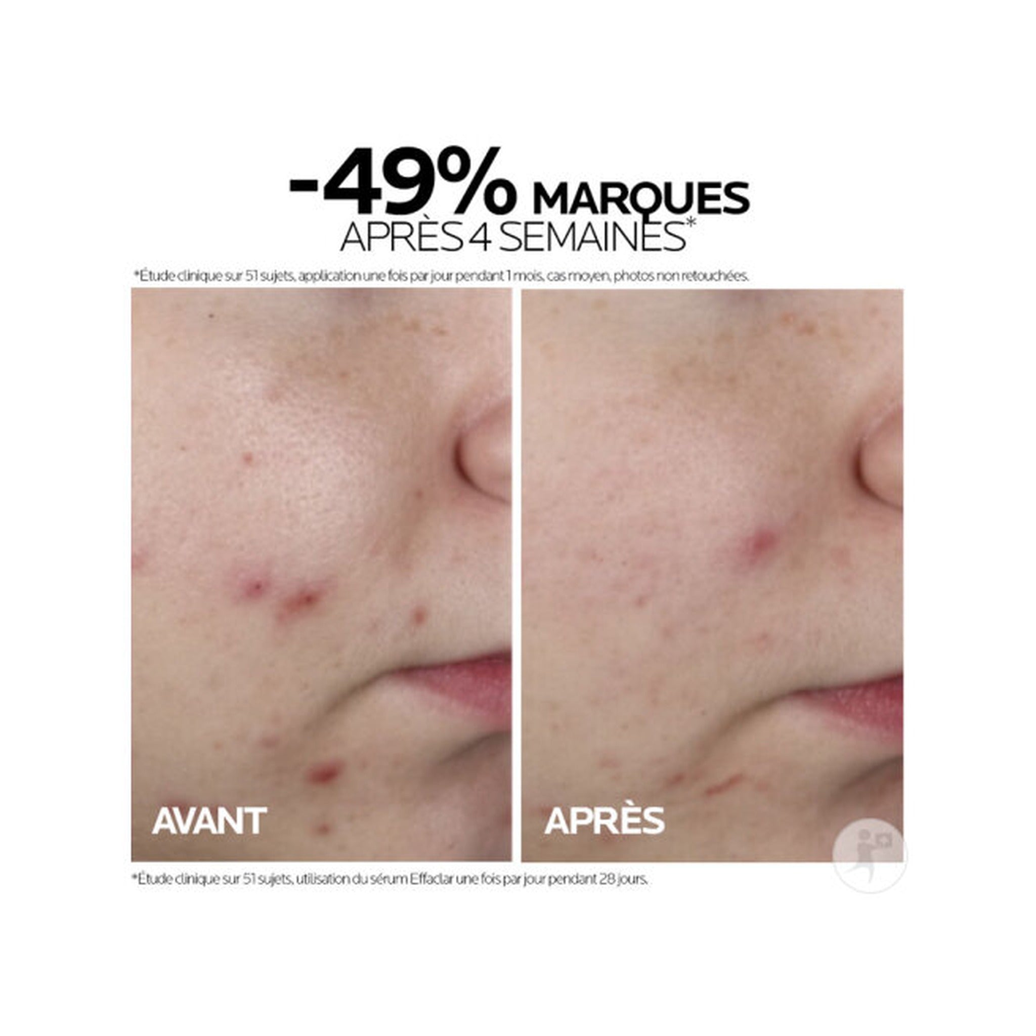 La Roche-Posay Effaclar Sérum Peeling Ultra Concentré 30ml