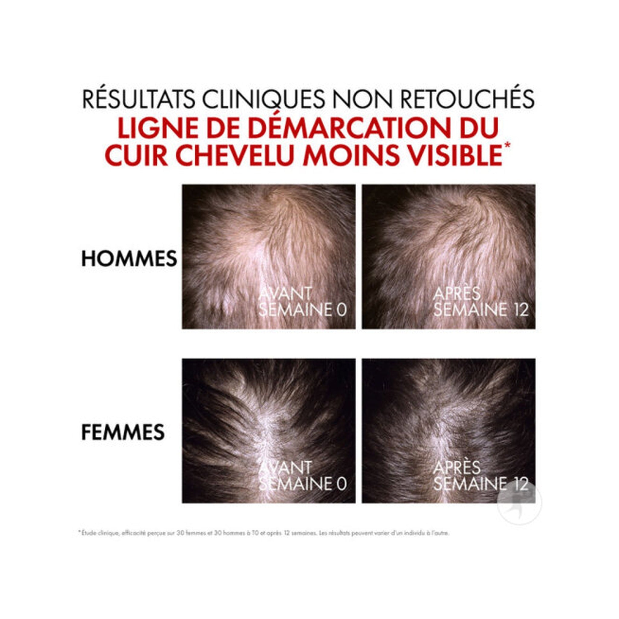 Vichy Dercos Sérum R.E.G.E.N Booster Régénératif Capillaire Flacon 90ml