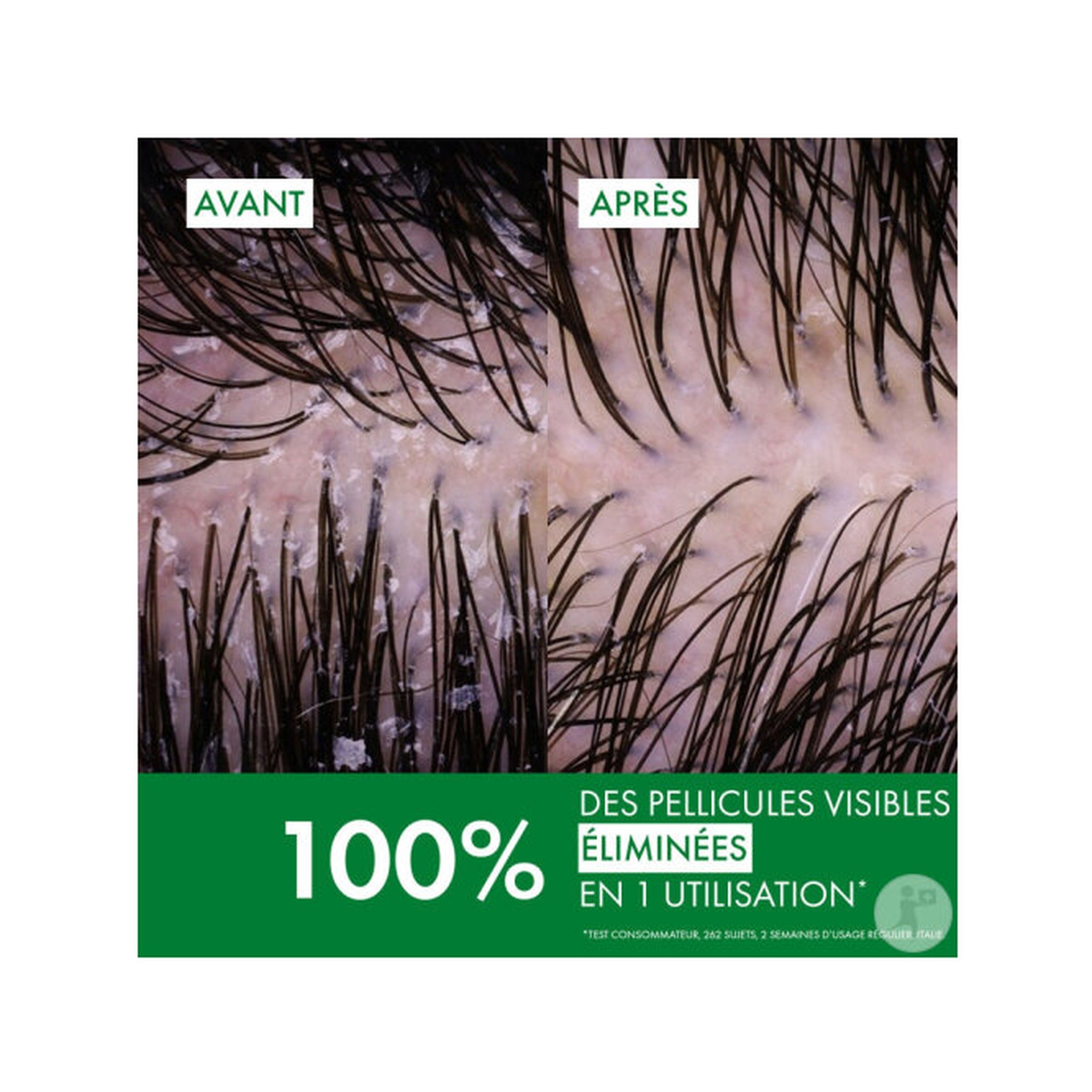 Vichy Dercos Shampoing Anti-Pelliculaire Cheveux Normaux à Gras Flacon-Pompe 390ml