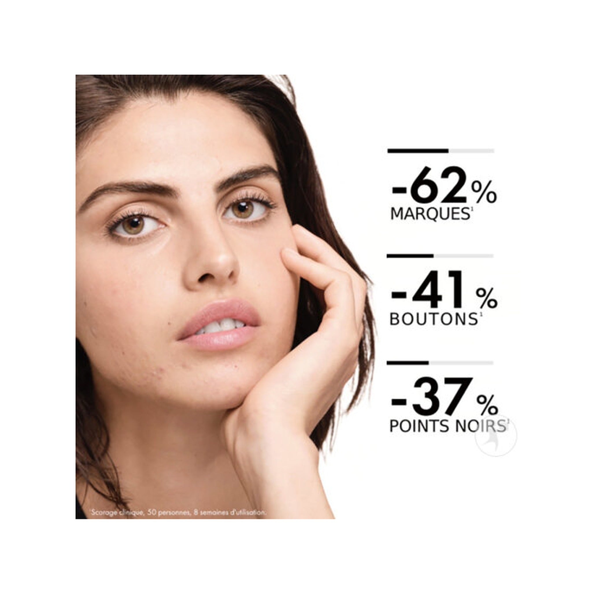 Vichy Normaderm Soin Hydratant Double-Correction Imperfections + Cicatrices Post-Acné 50ml